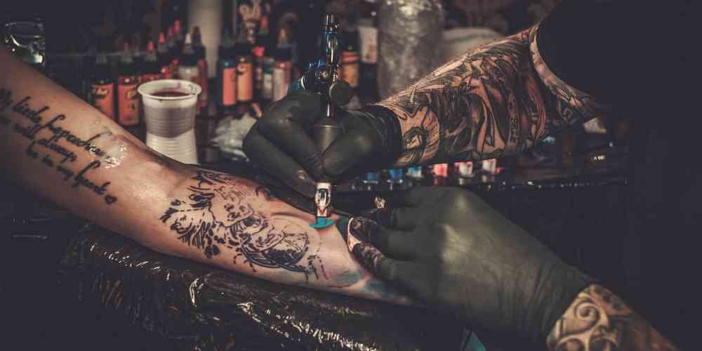 tattoo removal in kolkata